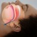 Sleep Apnea