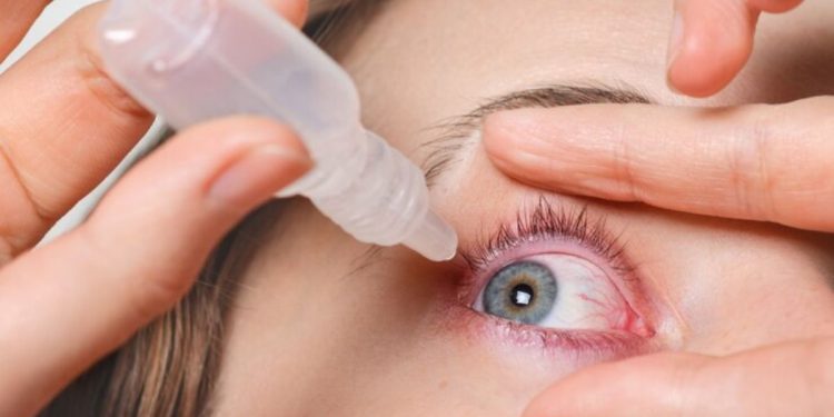 what is commonly misdiagnosed as pink eye