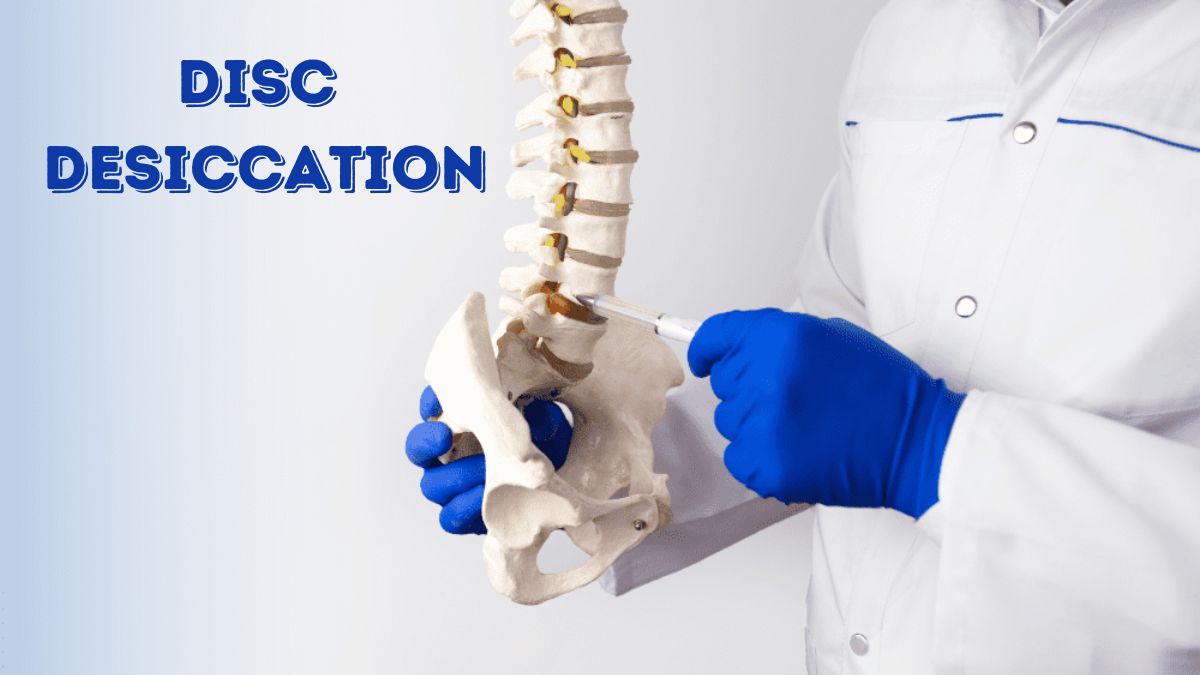 Disc Desiccation Understanding, Preventing, and Managing